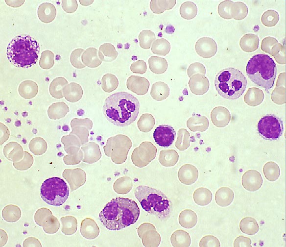 Blutplasma
